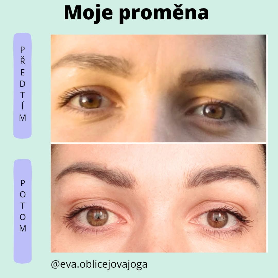 Obličejové okolí Předtím a potom