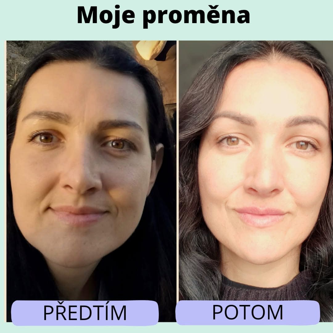 Celý obličej Předtím a potom